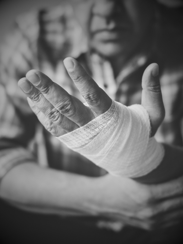 injured hand
